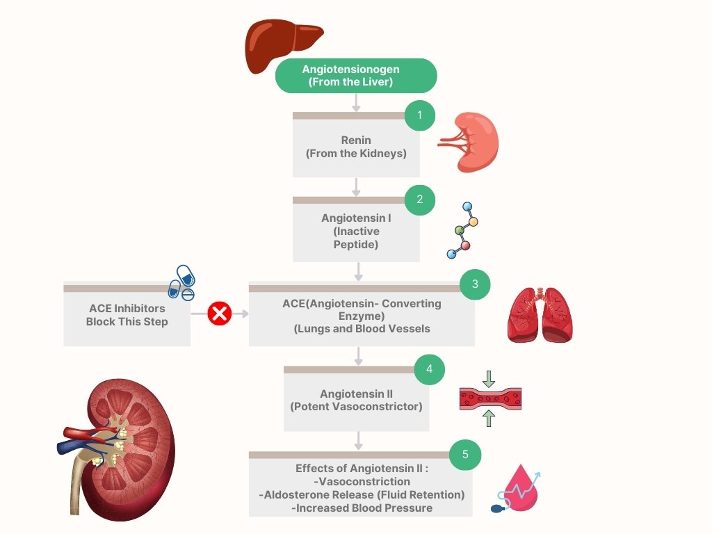 ACE inhibitors Flowchart