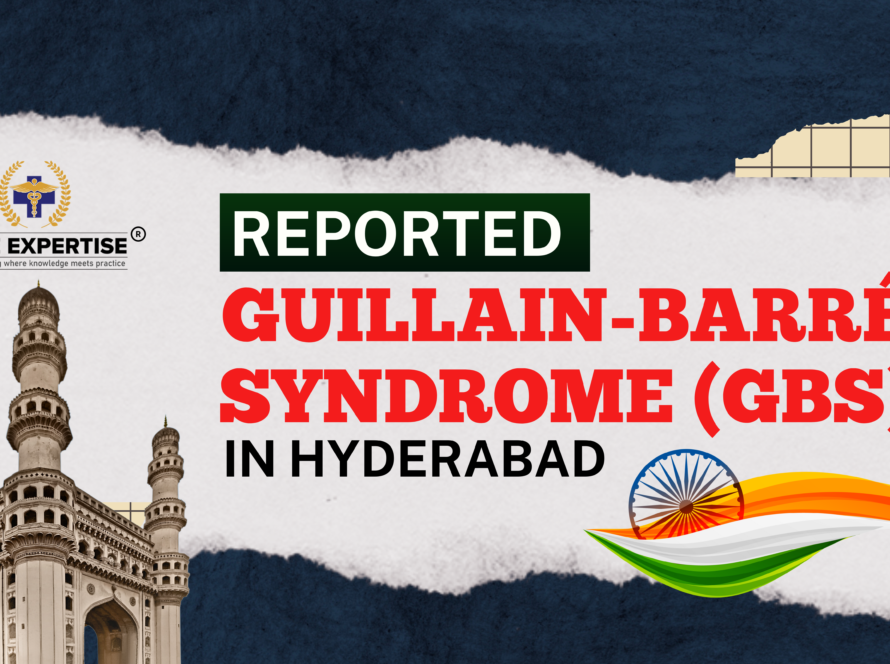 gullian barre syndrome